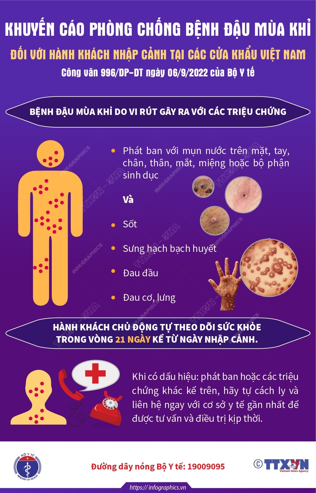 Khuyến cáo phòng chống bệnh Đậu mùa khỉ đối với hành khách nhập cảnh tại các cửa khẩu Việt Nam - Bài 2