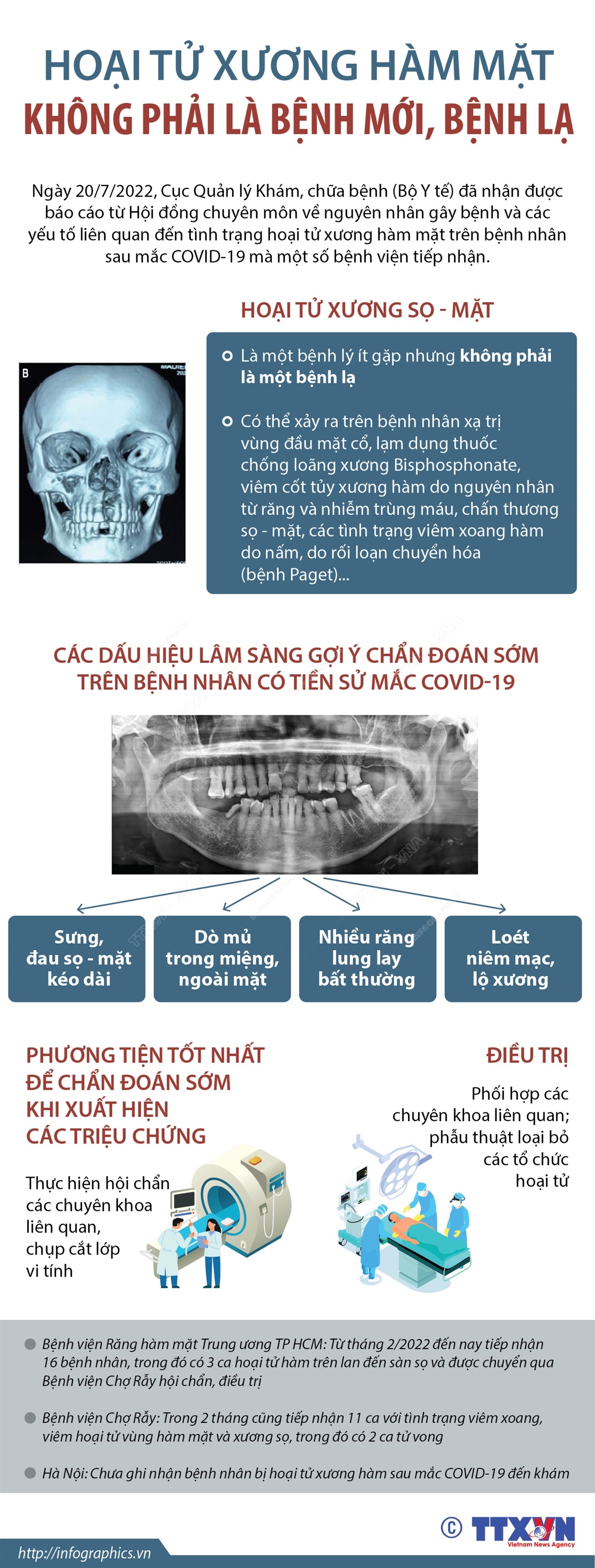 Kết luận về tình trạng hoại tử xương hàm mặt sau mắc COVID-19
