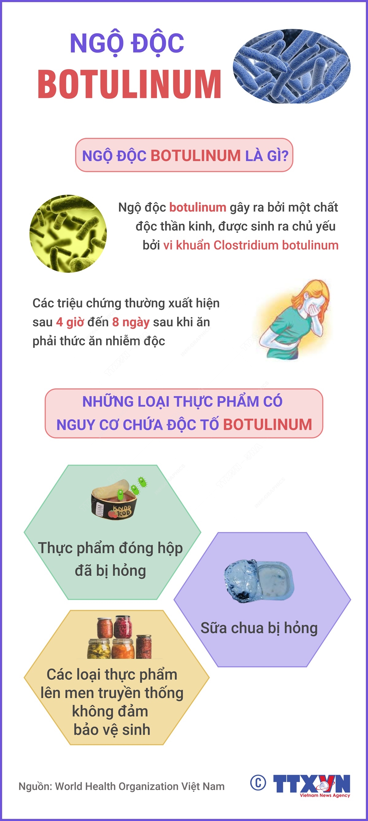 Ngộ độc Botulinum