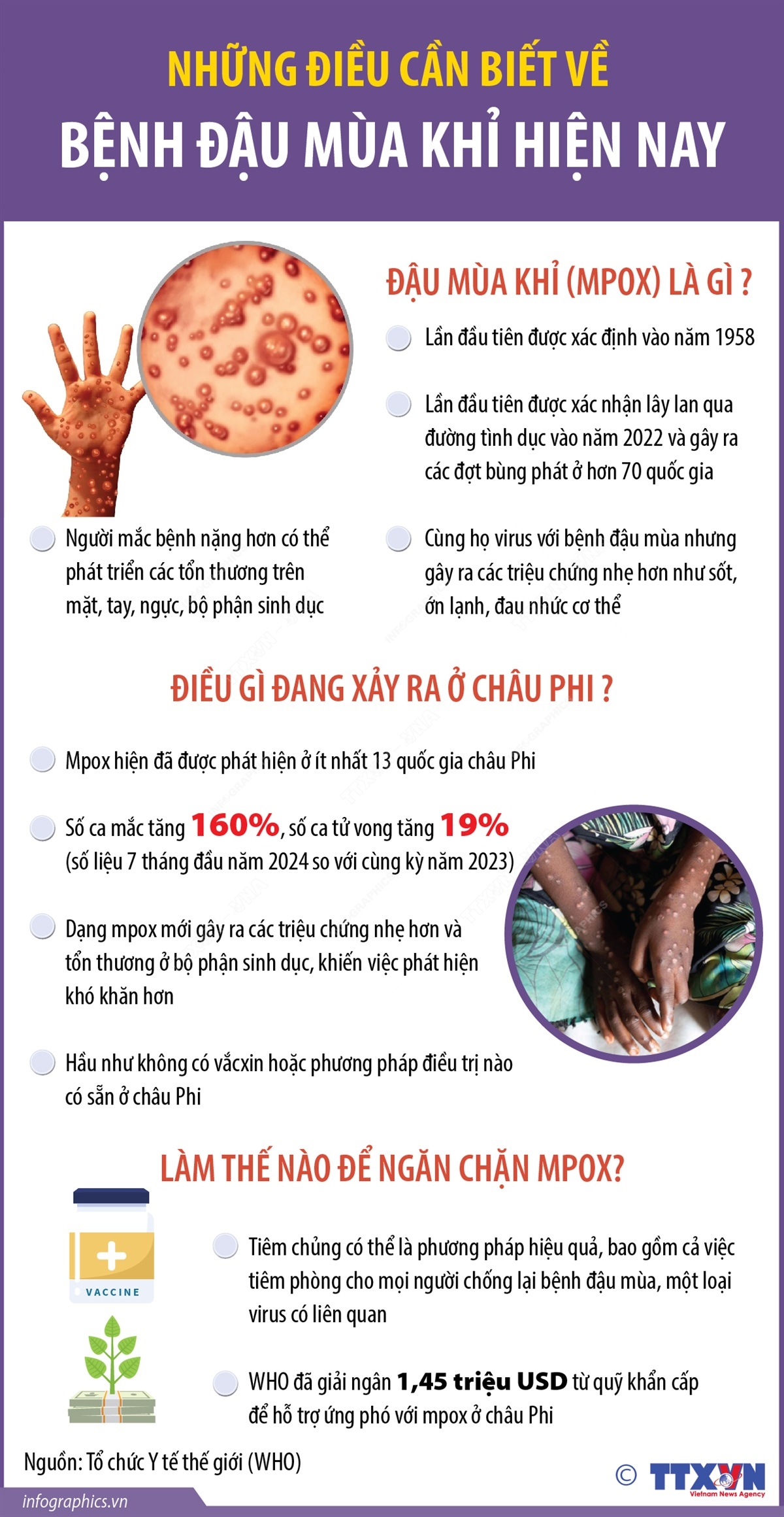 Những điều cần biết về bệnh đậu mùa khỉ hiện nay