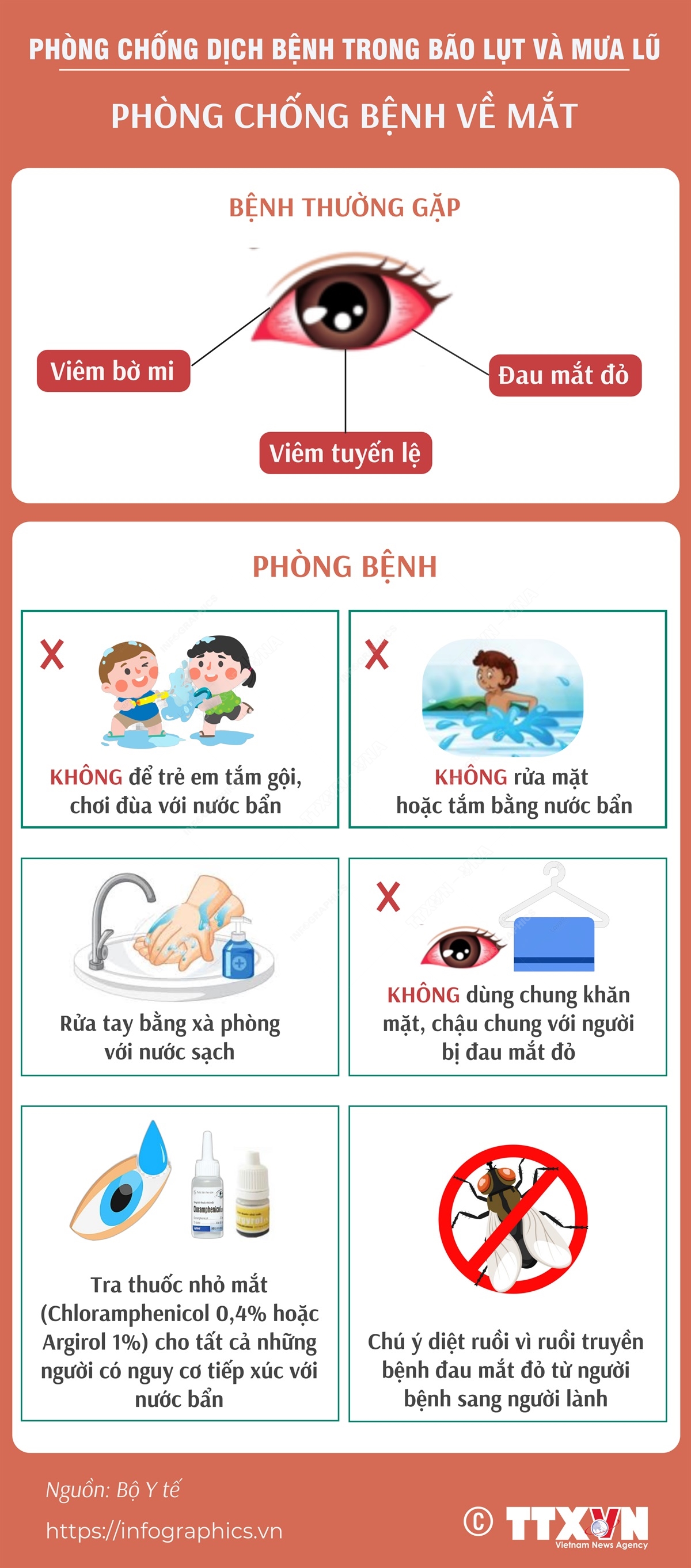 Phòng chống bệnh về mắt trong mùa bão lụt và mưa lũ