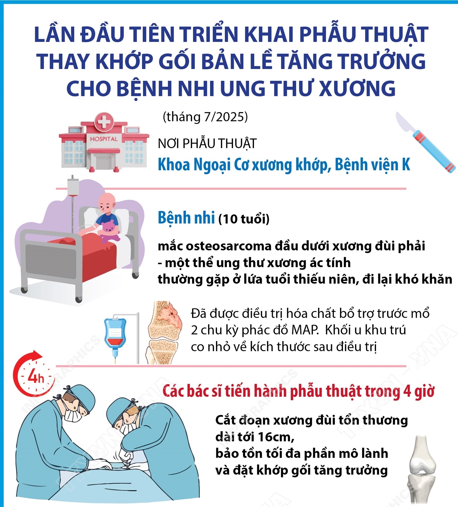 Lần đầu tiên triển khai phẫu thuật thay khớp gối bản lề tăng trưởng cho bệnh nhi ung thư xương