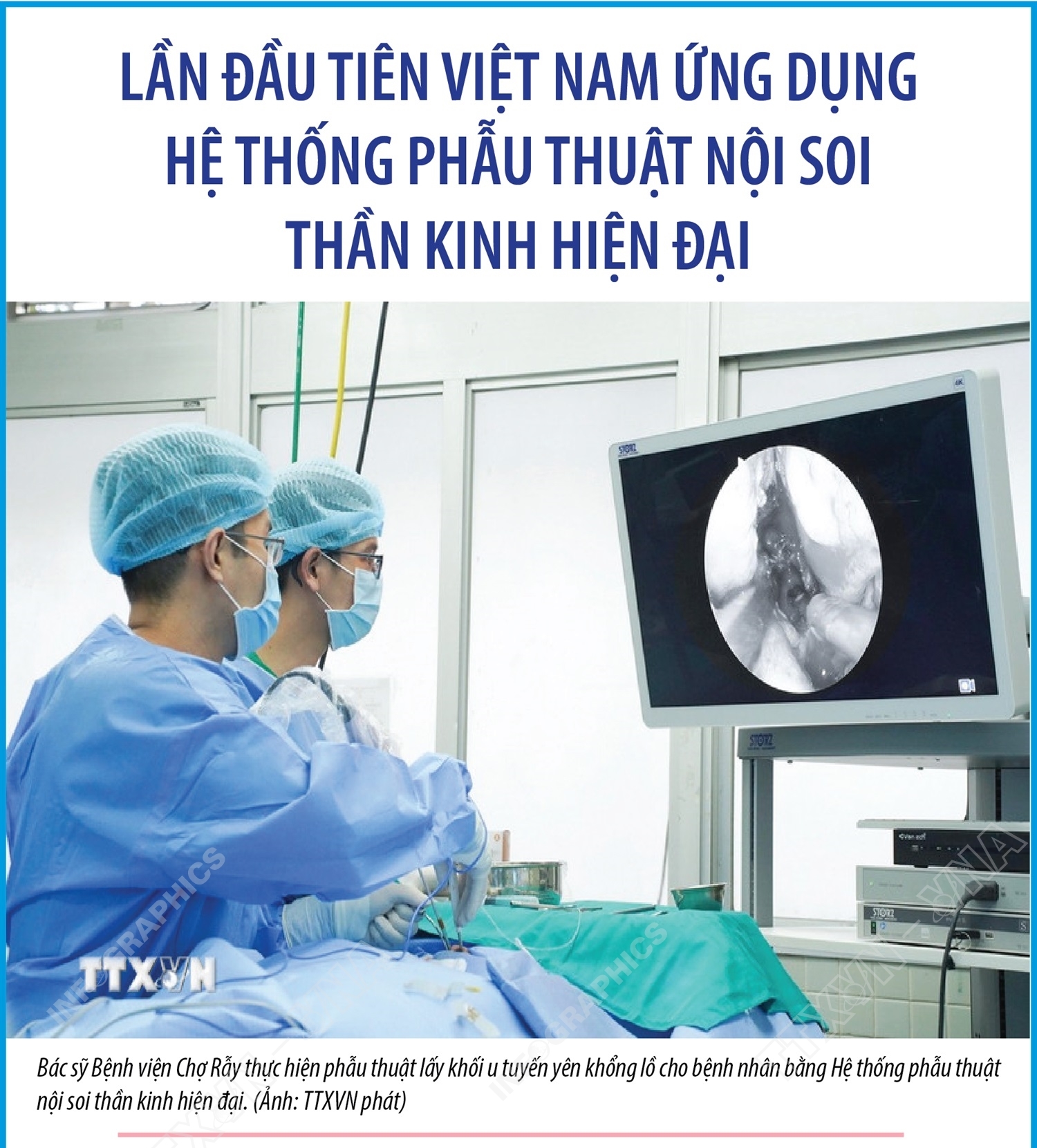 Lần đầu tiên Việt Nam ứng dụng hệ thống phẫu thuật nội soi thần kinh hiện đại