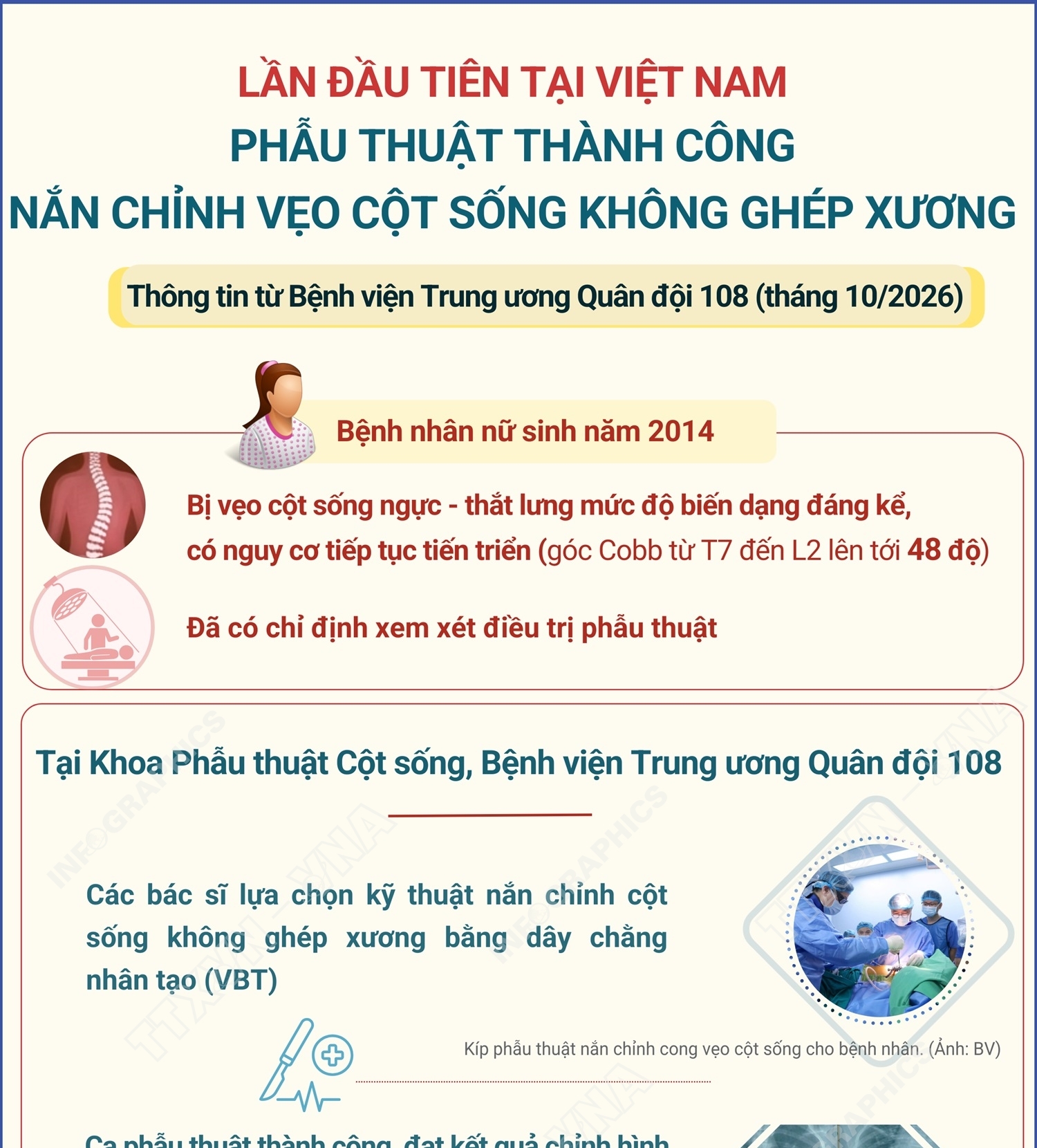 Lần đầu tiên tại Việt Nam phẫu thuật thành công nắn chỉnh vẹo cột sống...