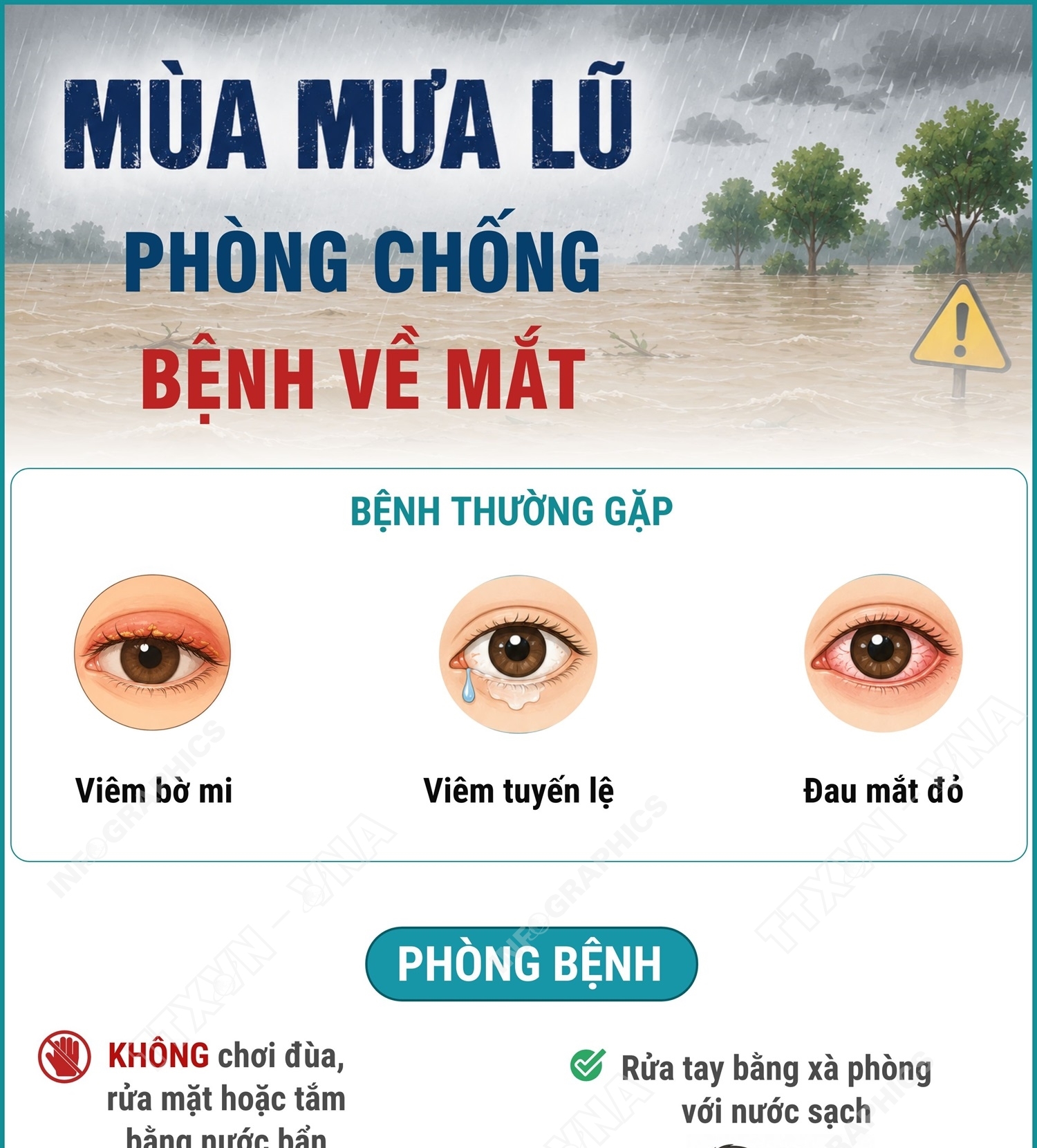 Phòng chống bệnh về mắt trong mùa mưa lũ