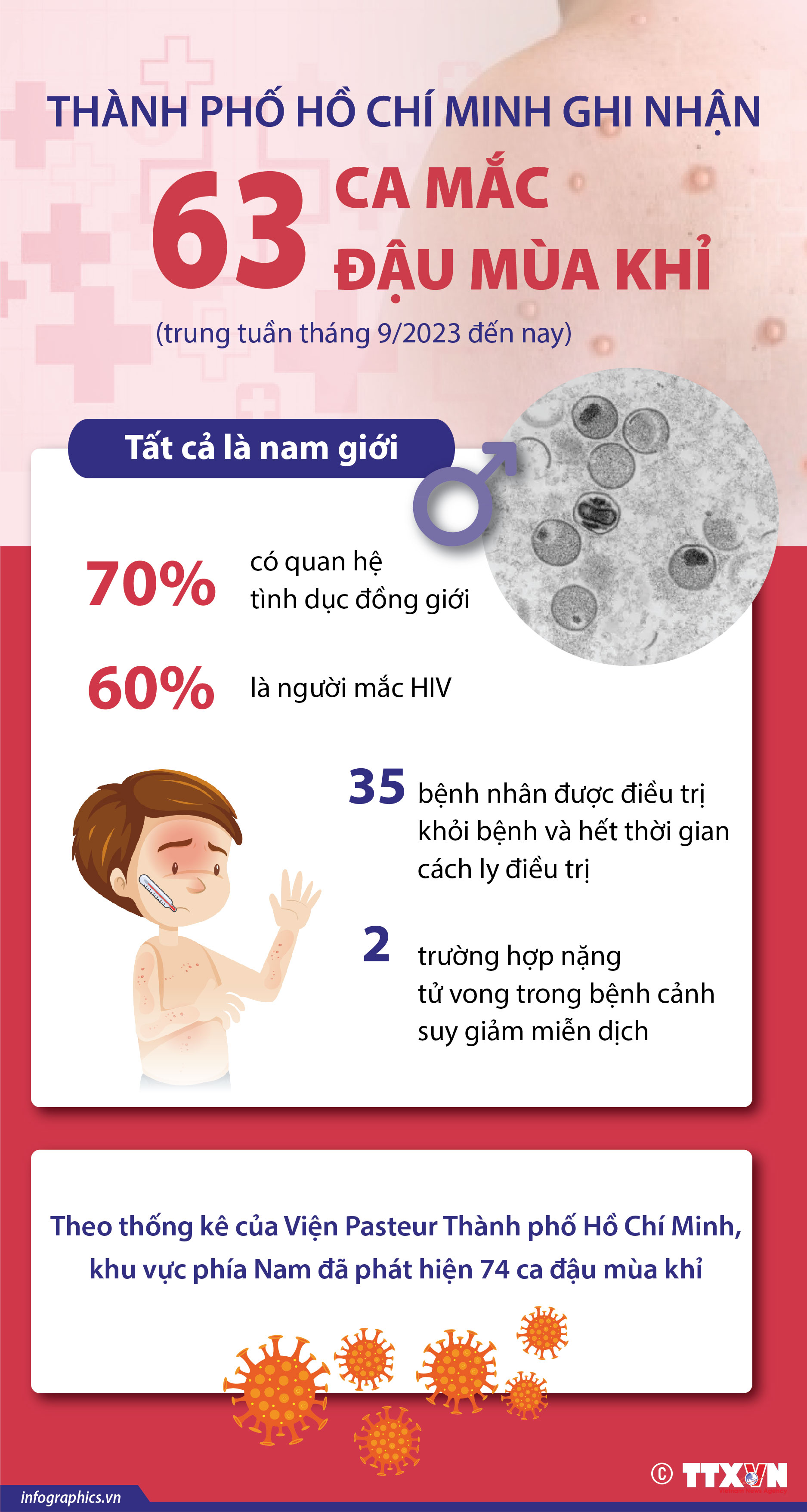 Thành phố Hồ Chí Minh ghi nhận 63 ca mắc đậu mùa khỉ