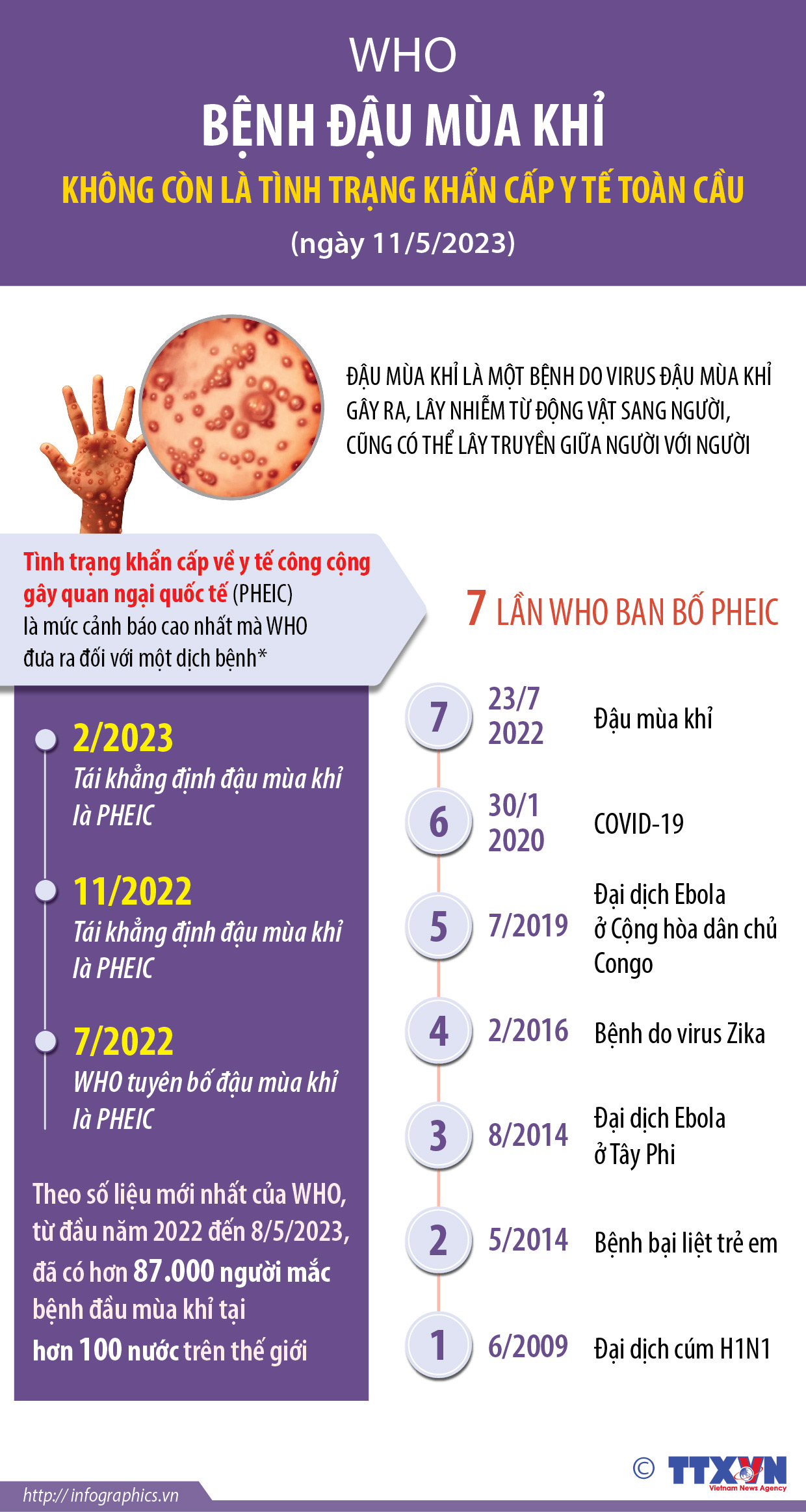 WHO: Bệnh đậu mùa khỉ không còn là tình trạng khẩn cấp y tế toàn...