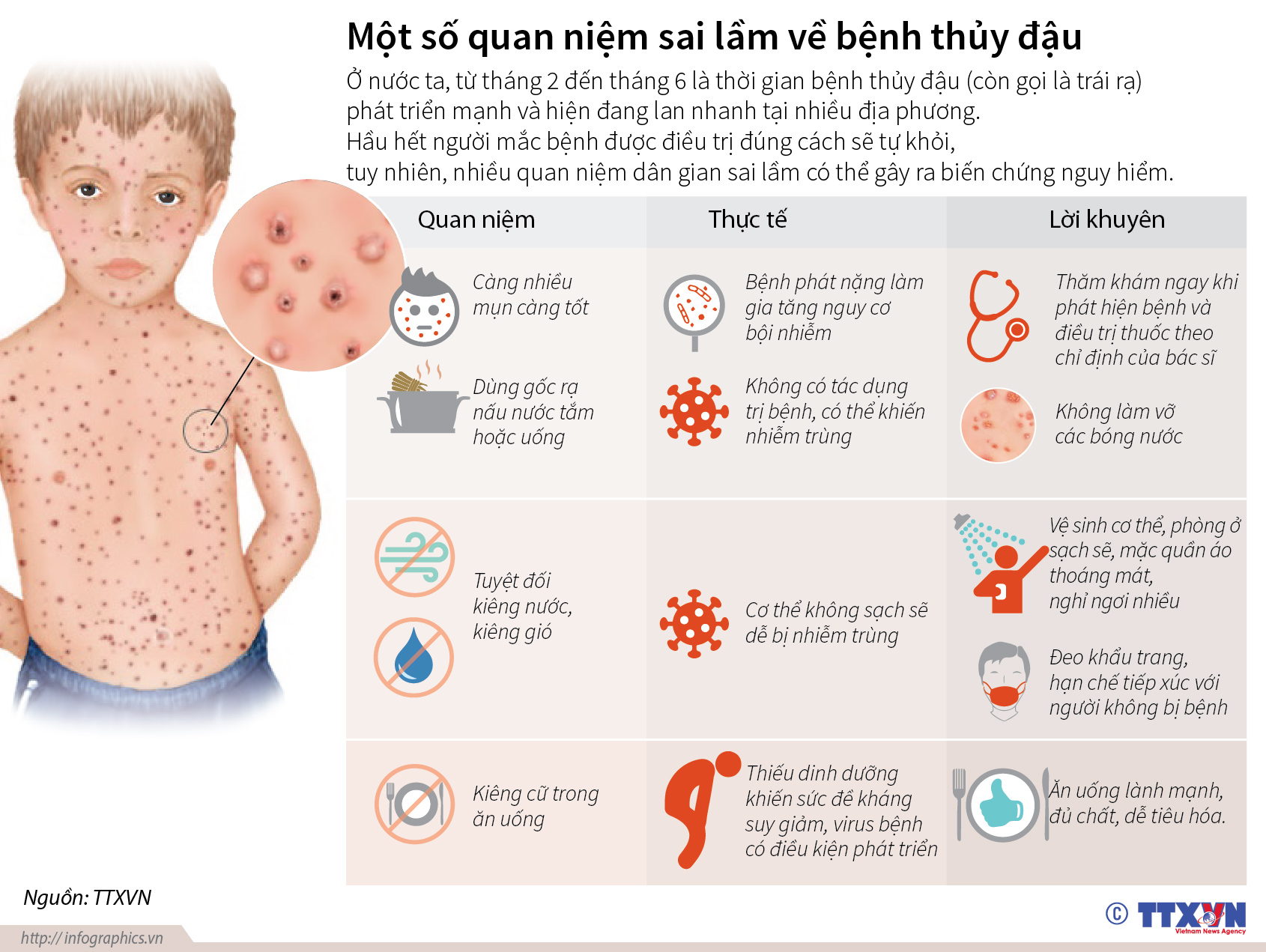 Một số quan niệm sai lầm về bệnh thủy đậu