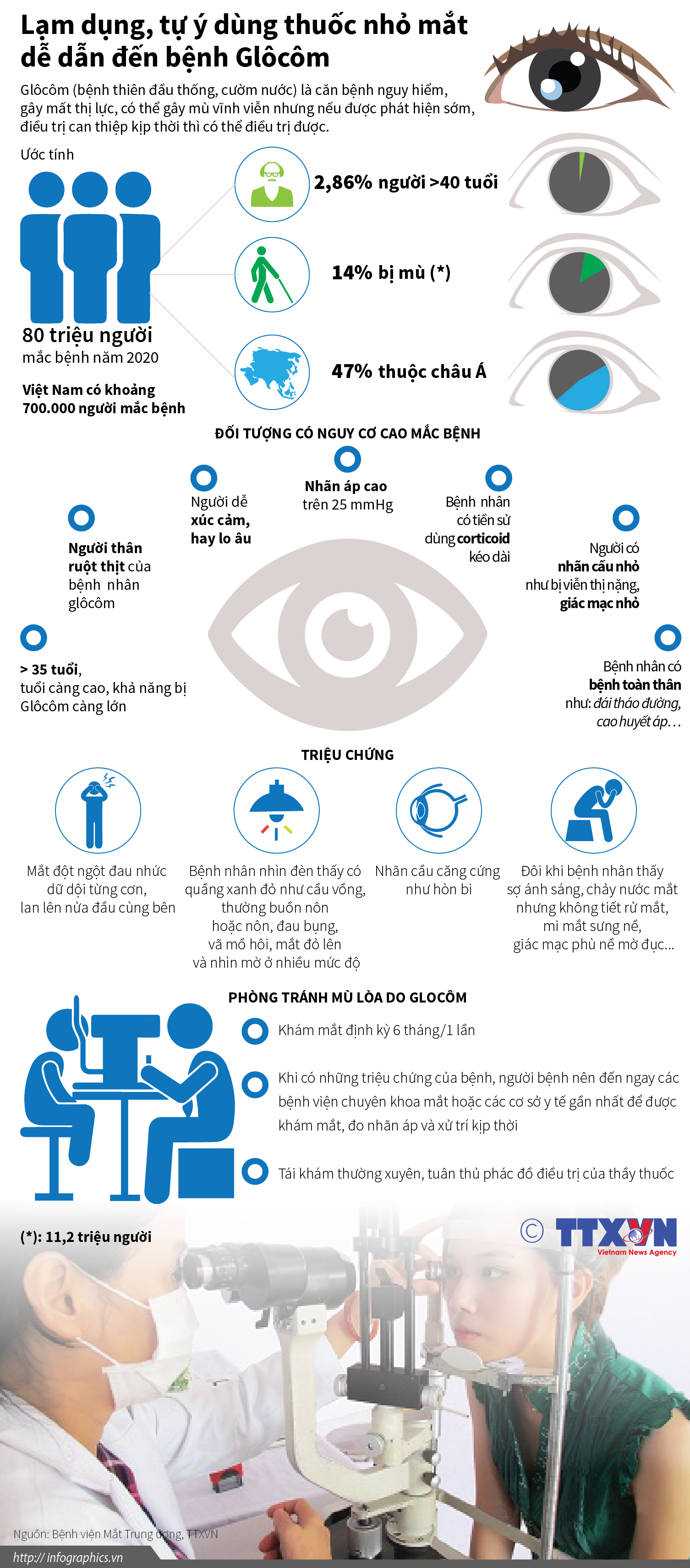 Lạm dụng, tự ý dùng thuốc nhỏ mắt dễ dẫn đến bệnh Glôcôm