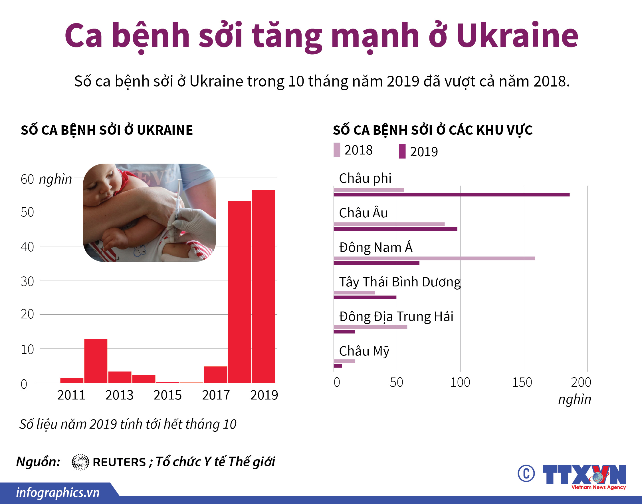 Ca bệnh sởi tăng mạnh ở Ukraine