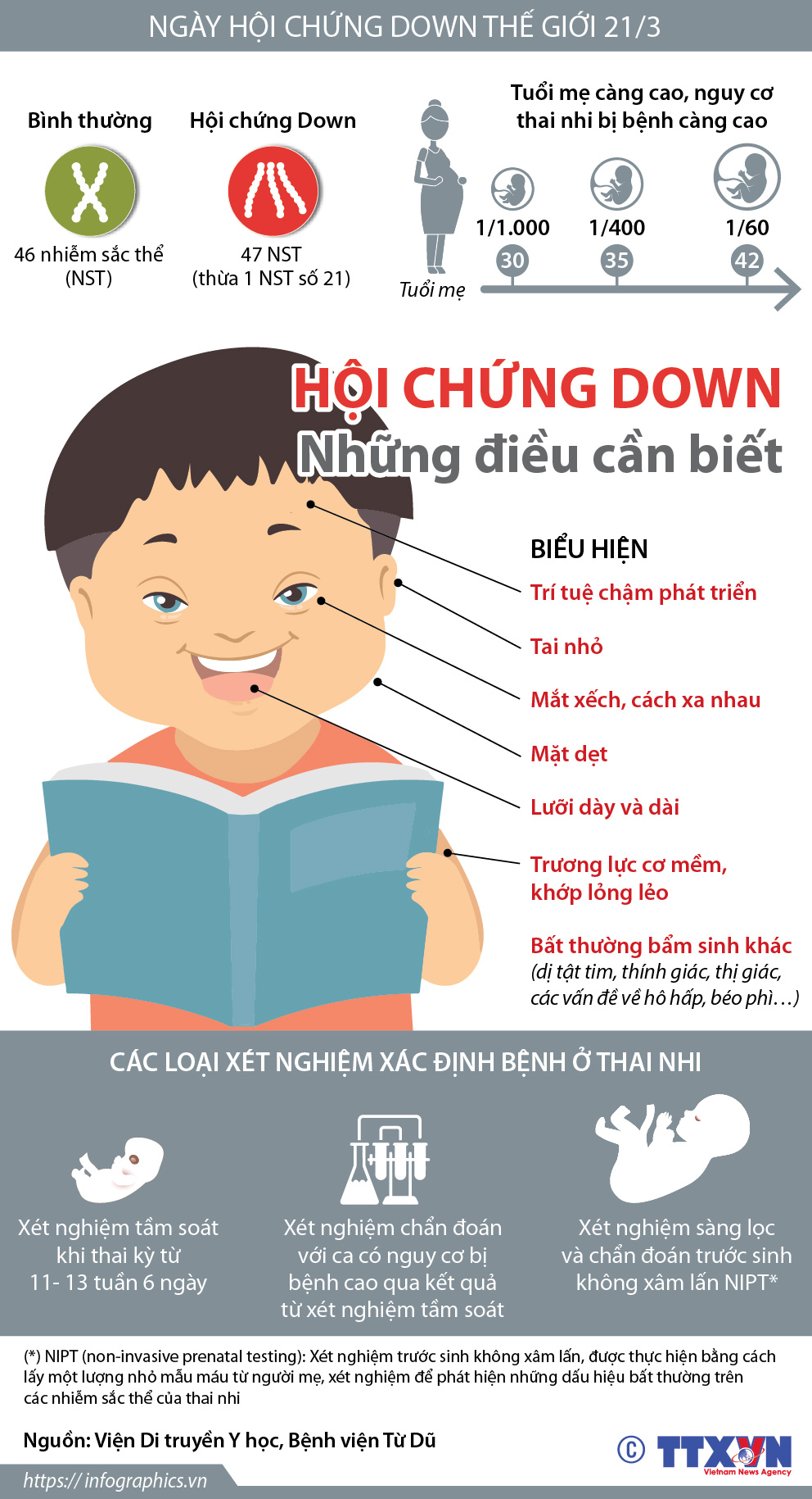 Biểu Hiện Bệnh Down: Triệu Chứng, Chẩn Đoán và Điều Trị